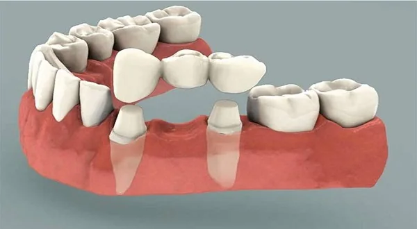 Basmati Clinics dental care